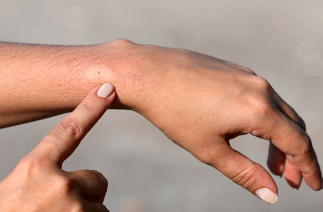 The Ultimate Simple Guide to Skin Allergies | Types,Triggers,Symptoms, and Treatment