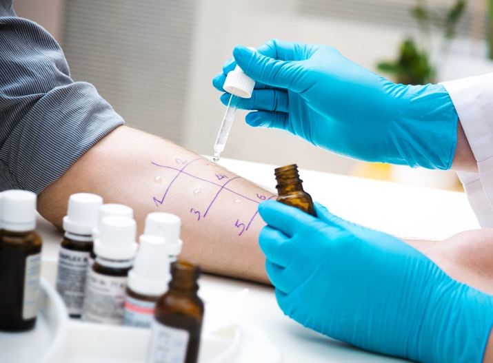 allergy test