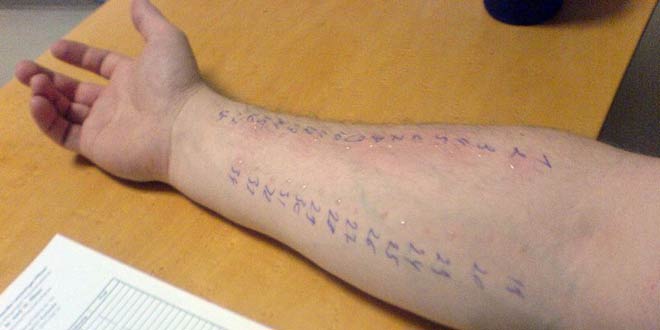Allergy Testing – A Beginner’s Guide – How It is done?