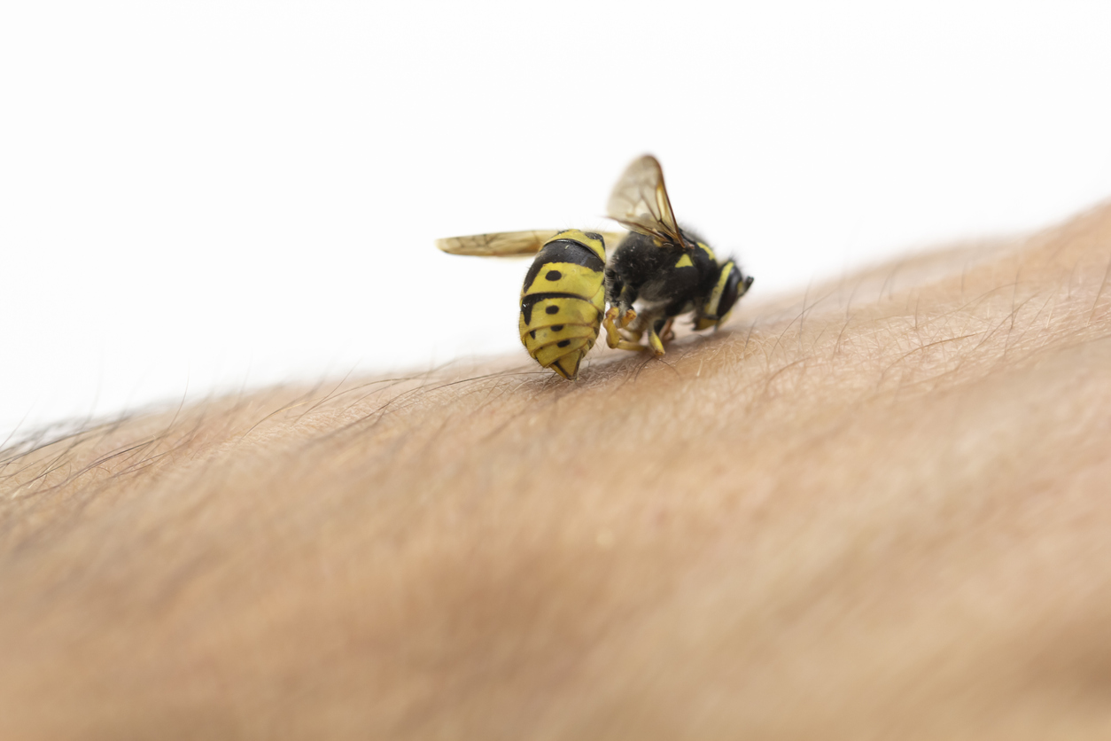 Bee Sting Allergies – A Dangerous Problem!